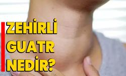 Zehirli Guatr Nedir?