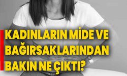 Kadınların mide ve bağırsaklarından bakın ne çıktı?