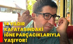 14 yıldır kafatasındaki iğne parçacıklarıyla yaşıyor!