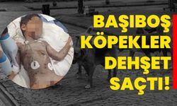 Başıboş Köpekler Dehşet Saçtı! 5 Yaşındaki Çocuk Ağır Yaralandı