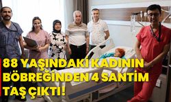 88 yaşındaki kadının böbreğinden 4 santim taş çıktı!