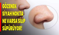 GÖZENEK, SİYAH NOKTA NE VARSA SİLİP SÜPÜRÜYOR!