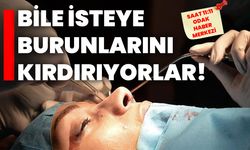 BİLE İSTEYE BURUNLARINI KIRDIRIYORLAR