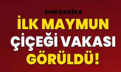 İlk Maymun Çiçeği Vakası Görüldü