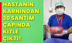 Hastanın karnından 30 santim çapında kitle çıktı!