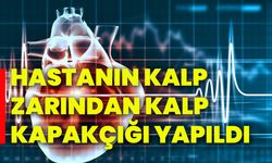 Hastanın kalp zarından kalp kapakçığı yapıldı