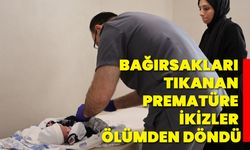 Bağırsakları tıkanan prematüre ikizler ölümden döndü