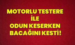 Motorlu testere ile odun keserken bacağını kesti!