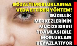 Gözaltı Morluklarına Veda Ettiren Yöntem! Güzellik Merkezlerinin Mucize Sırrı! 1 Damlası Bile Morlukları Beyazlatıyor