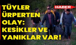 Tüyler Ürperten Olay: Kesikler Ve Yanıklar!