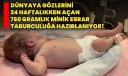 Dünyaya gözlerini 24 haftalıkken açan 760 gramlık minik Ebrar taburculuğa hazırlanıyor