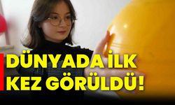 Dünyada ilk kez görüldü!