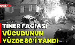 Tiner Faciası: Vücudunun Yüzde 80’i Yandı