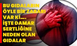 Bu gıdaların öyle bir zararı var ki…. İşte damar sertliğine neden olan gıdalar