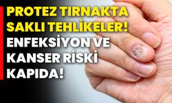 Protez Tırnakta Saklı Tehlikeler! Enfeksiyon ve Kanser Riski Kapıda!