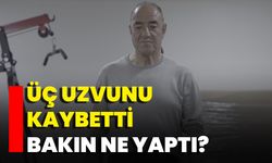 Üç Uzvunu Kaybetti Bakın Ne Yaptı?