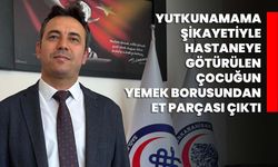Yutkunamama şikayetiyle hastaneye götürülen çocuğun yemek borusundan et parçası çıktı