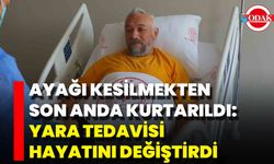 Ayağı Kesilmekten Son Anda Kurtarıldı: Yara Tedavisi Hayatını Değiştirdi