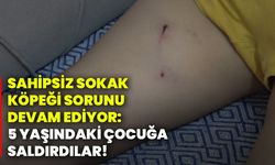 Sahipsiz sokak köpeği sorunu devam ediyor: 5 yaşındaki çocuğa saldırdılar!