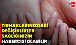 Tırnaklarınızdaki Değişiklikler Sağlığınızın Habercisi Olabilir