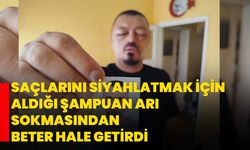 Saçlarını siyahlatmak için aldığı şampuan arı sokmasından beter hale getirdi