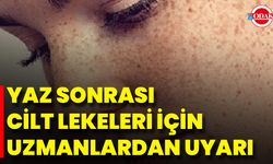 Yaz Sonrası Cilt Lekeleri İçin Uzmanlardan Uyarı