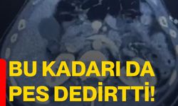 Bu kadarı da pes dedirtti!