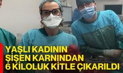 Yaşlı kadının şişen karnından 6 kiloluk kitle çıkarıldı