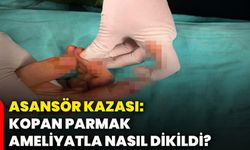 Asansör kazası: Kopan parmak ameliyatla nasıl dikildi?