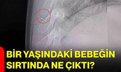 Bir Yaşındaki Bebeğin Sırtında Ne Çıktı?