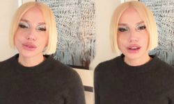 Gülşen’in Yüzündeki Değişim Sosyal Medyada Gündem Oldu