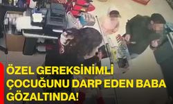 Özel gereksinimli çocuğunu darp eden baba gözaltında!
