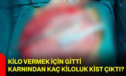 Kilo Vermek İçin Gitti, Karnından Kaç Kiloluk Kist Çıktı?