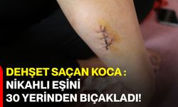 Dehşet Saçan Koca : Nikahlı Eşini 30 Yerinden Bıçakladı!