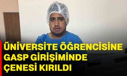 Üniversite öğrencisine gasp girişiminde çenesi kırıldı