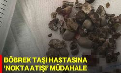 Böbrek taşı hastasına ’nokta atışı’ müdahale