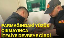 Parmağındaki yüzük çıkmayınca itfaiye devreye girdi