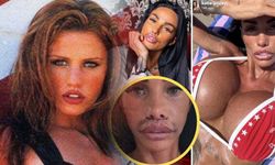 Katie Price 43 estetik operasyon sonrası gündem oldu