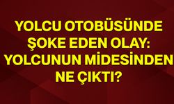 Yolcu otobüsünde şoke eden olay: Yolcunun midesinden ne çıktı?