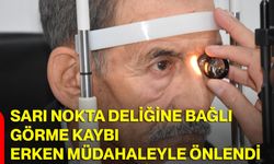 Sarı nokta deliğine bağlı görme kaybı erken müdahaleyle önlendi