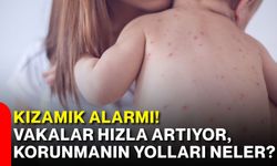 Kızamık alarmı! Vakalar hızla artıyor, korunmanın yolları neler?