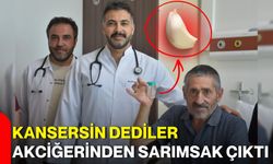 Kansersin dediler akciğerinden sarımsak çıktı