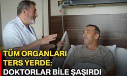 Tüm organları ters yerde: Doktorlar bile şaşırdı