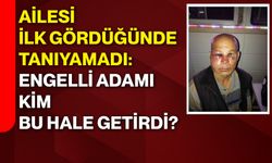 Ailesi ilk gördüğünde tanıyamadı: Engelli adamı kim bu hale getirdi?