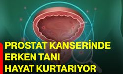 Prostat kanserinde erken tanı hayat kurtarıyor