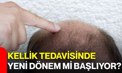 Kellik tedavisinde yeni dönem mi başlıyor?