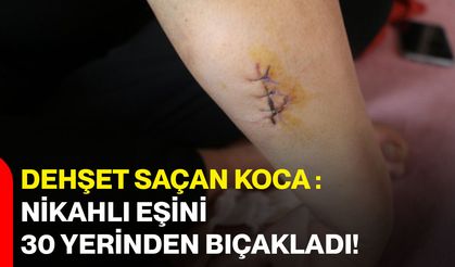 Dehşet Saçan Koca : Nikahlı Eşini 30 Yerinden Bıçakladı!