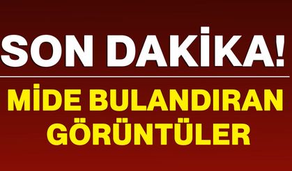 Mide bulandıran görüntüler