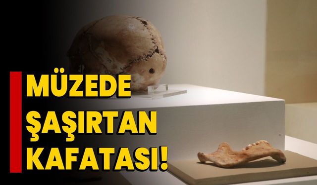 Müzede Şaşırtan Kafatası!