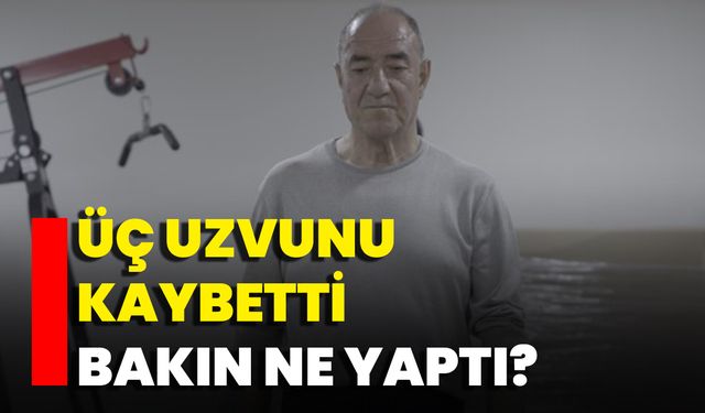 Üç Uzvunu Kaybetti Bakın Ne Yaptı?